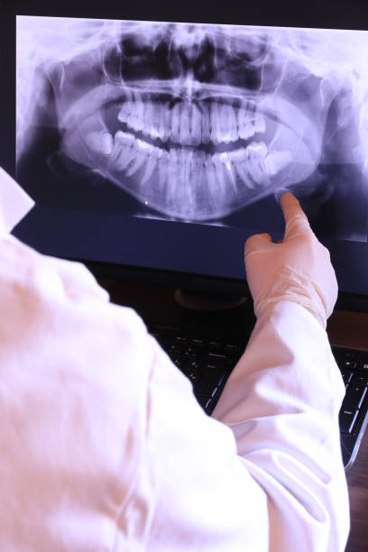 Best Emergency Wisdom Tooth Extraction in Mansfield, MO