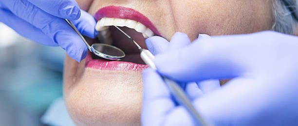 Best Broken or Chipped Tooth Repair in Mansfield, MO